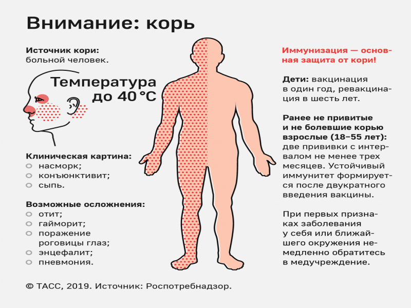 Корь - информация для населения!.